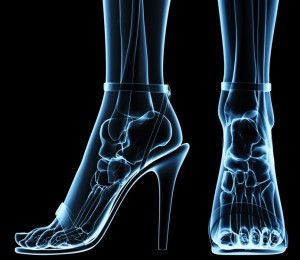 women's feet under x-ray